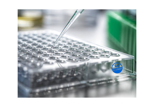 [CSB-PA000809] ELISA   ACTB|POTEKP|ACTG1 anti-