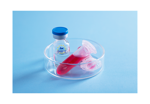 [GEN - PYT610-1mg] TFF1 Human, His