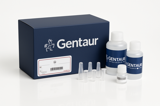 [sk5634] Soil N-Acetyl-Beta-D-Glucosaminidase Activity Assay